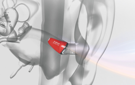 用声音传递一份爱