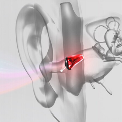 爱可声助听器验配专家教你如何使用各型号助听器