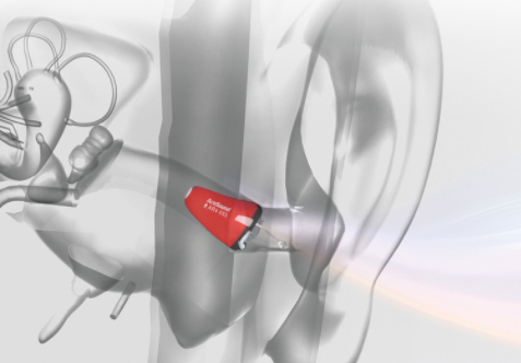 佩戴助听器后失聪女孩终于找到工作