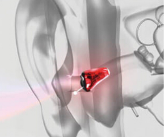 戴上爱可声助听器后和正常听力一样吗？