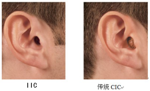 隐形助听器和耳内式助听器的区别